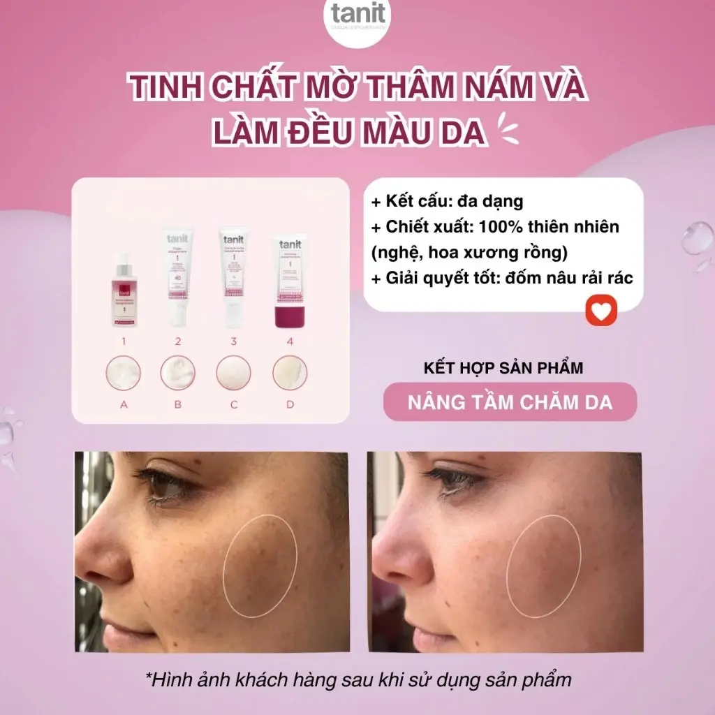 kem-tanit-plus-15ml-giai-phap-mo-tham-nam-chuyen-biet-xoa-sach-dom-nau-tan-nhang-tan-goc-9.webp