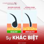 Viên Uống Complidermol 5 Alpha: Giải Pháp Chuyên Sâu Cho Tóc Rụng Do Hormone